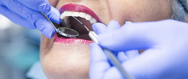 Best Emergency Dental Surgery in El Jon, CA